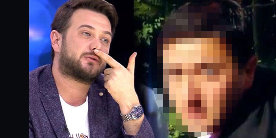 Bambaşka biri olmuş! Ünlülerin estetiksiz halleri...