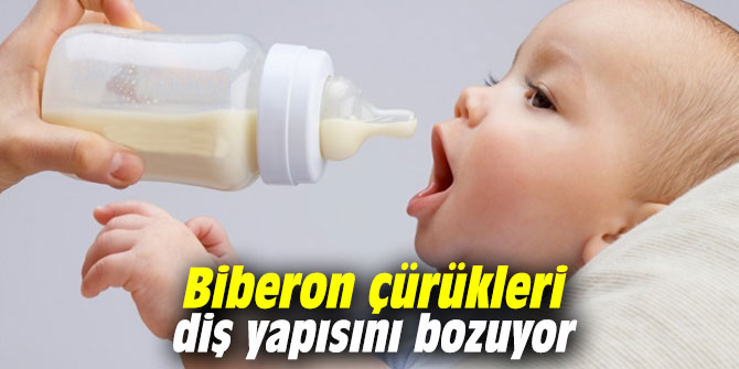 Biberon çürükleri diş yapısını bozuyor