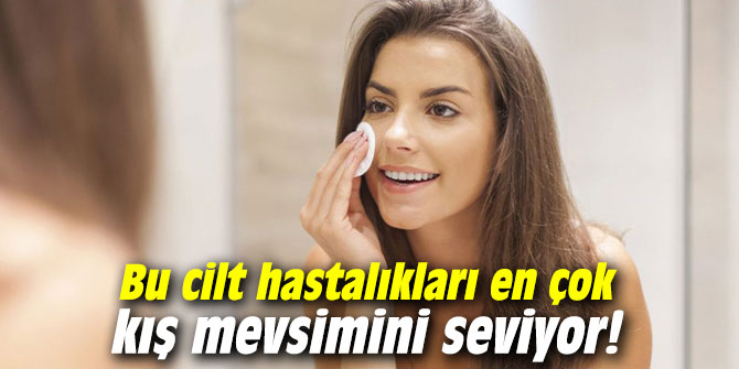 Bu cilt hastalıkları en çok kış mevsimini seviyor!