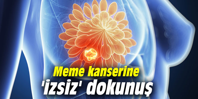 Meme kanserine 'izsiz' dokunuş