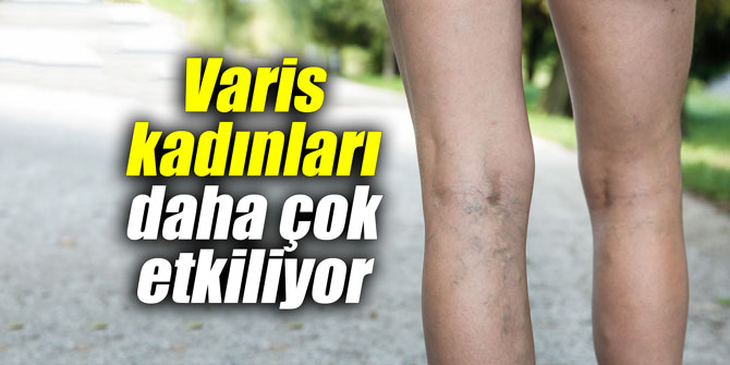 Varis kadınları daha çok etkiliyor