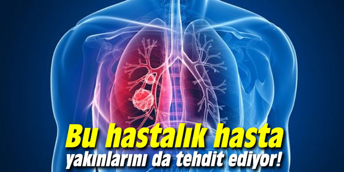 Bu hastalık hasta yakınlarını da tehdit ediyor!