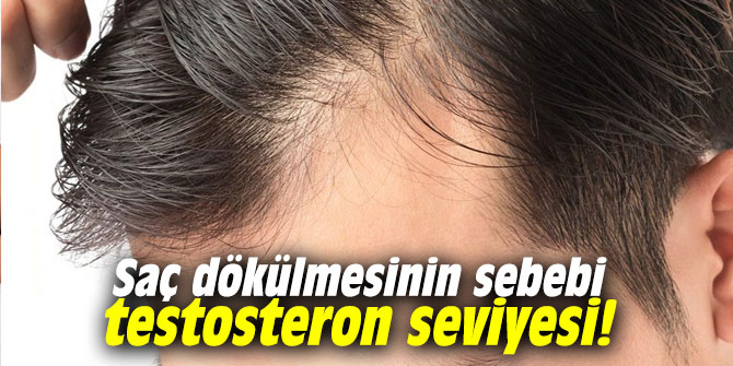 Saç dökülmesinin sebebi testosteron seviyesi!