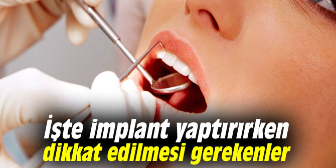 İşte implant yaptırırken dikkat edilmesi gerekenler