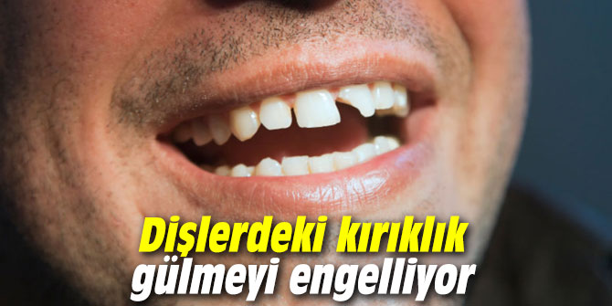 Dişlerdeki kırıklık gülmeyi engelliyor