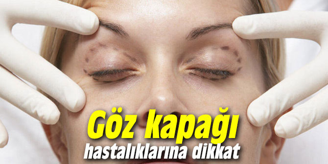 Göz kapağı hastalıklarına dikkat