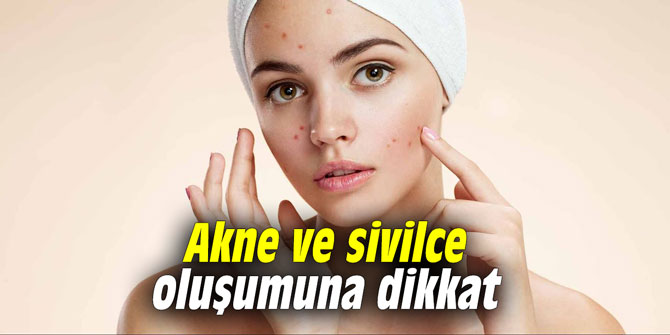 Akne ve sivilce oluşumuna dikkat
