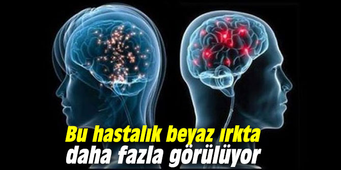 Bu hastalık beyaz ırkta daha fazla görülüyor
