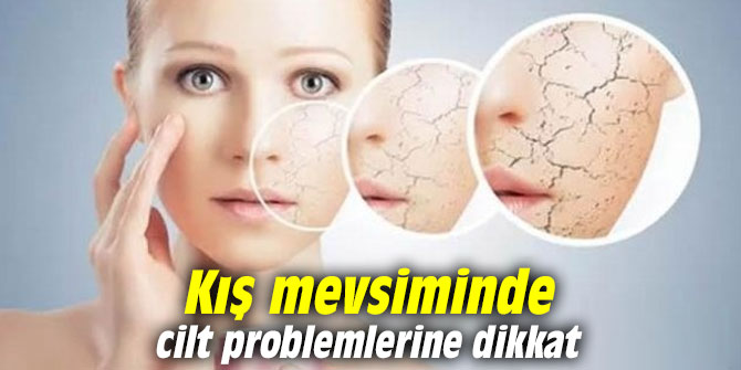 Kış mevsiminde cilt problemlerine dikkat
