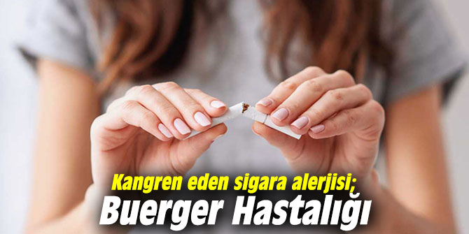 Kangren eden sigara alerjisi; Buerger Hastalığı