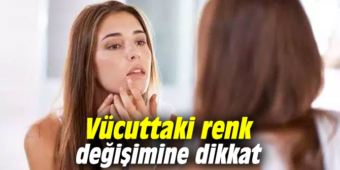 Vücuttaki renk değişimine dikkat