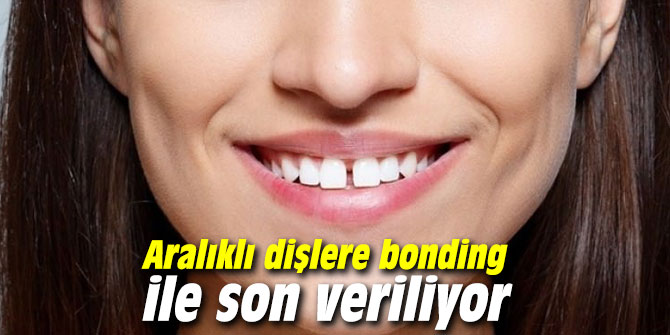 Aralıklı dişlere bonding ile son veriliyor