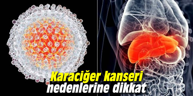 Karaciğer kanseri nedenlerine dikkat