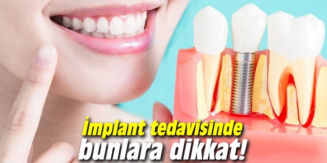 İmplant tedavisinde bunlara dikkat!