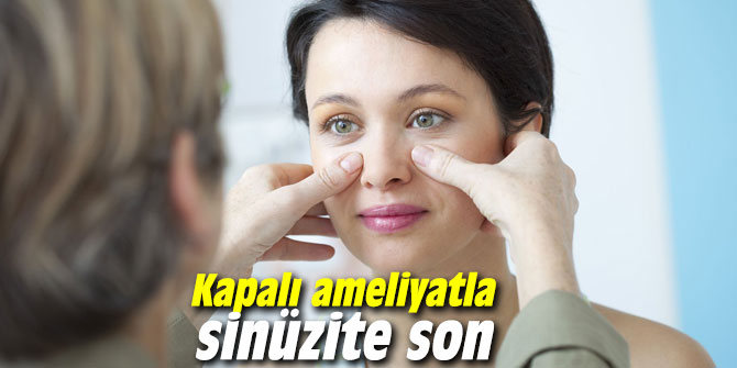 Kapalı ameliyatla sinüzite son