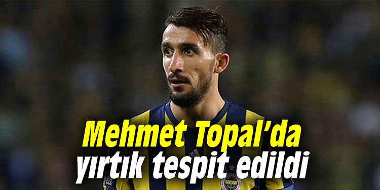 Mehmet Topal’da yırtık tespit edildi