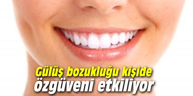 Gülüş bozukluğu kişide özgüveni etkiliyor