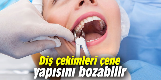 Diş çekimleri çene yapısını bozabilir