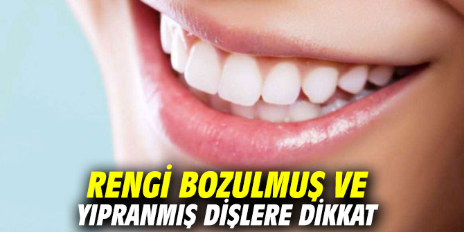 Rengi bozulmuş ve yıpranmış dişlere dikkat