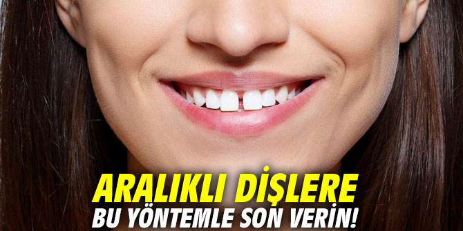 Aralıklı dişlere bu yöntemle son verin!