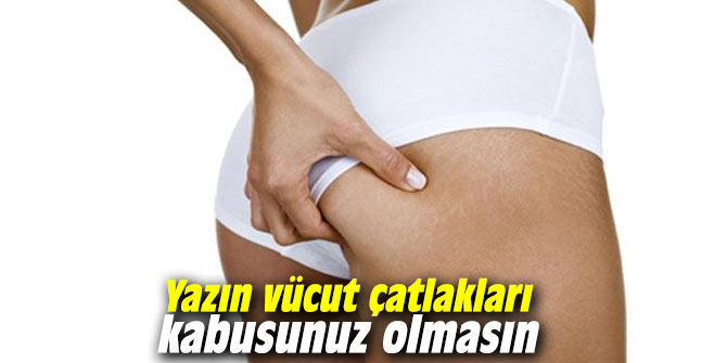 Yazın vücut çatlakları kabusunuz olmasın