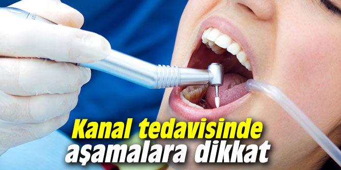 Kanal tedavisinde aşamalara dikkat