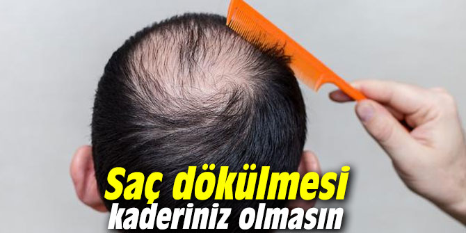 Saç dökülmesi kaderiniz olmasın
