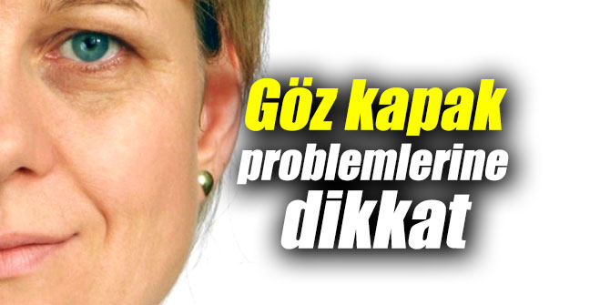 Göz kapak problemlerine dikkat