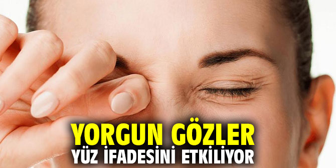 Yorgun gözler yüz ifadesini etkiliyor