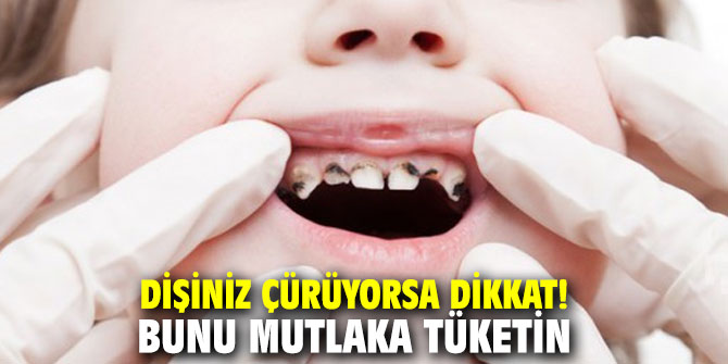 Dişiniz çürüyorsa dikkat! Bunu mutlaka tüketin