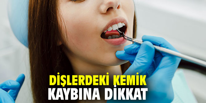 Dişlerdeki kemik kaybına dikkat
