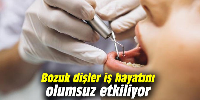 Bozuk dişler iş hayatını olumsuz etkiliyor