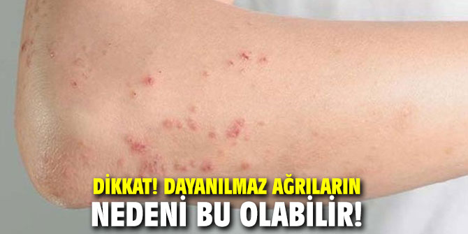 Dikkat! Dayanılmaz ağrıların nedeni bu olabilir!