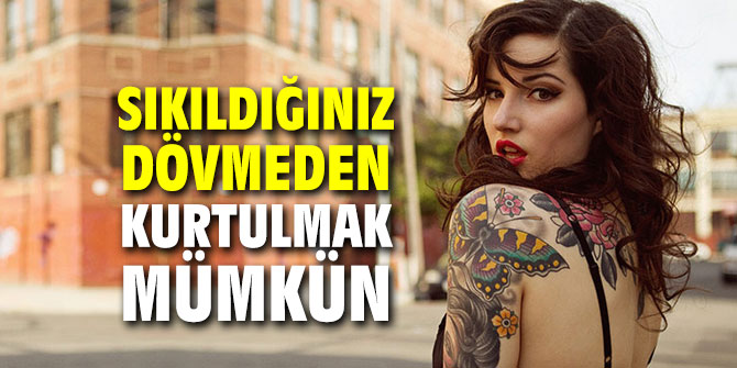 Sıkıldığınız dövmeden kurtulmak mümkün