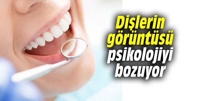 Dişlerin görüntüsü psikolojiyi bozuyor
