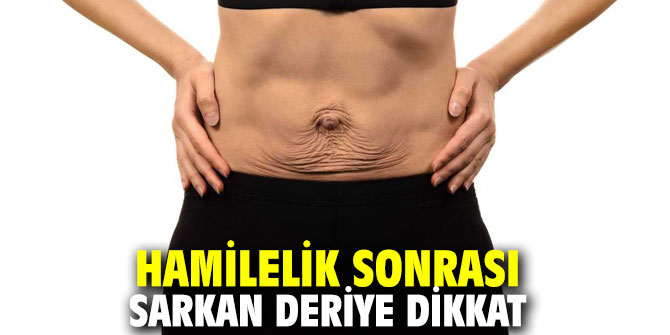 Hamilelik sonrası sarkan deriye dikkat