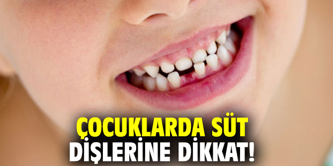 Uzmanından çocuklarda süt dişleri uyarısı
