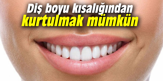Diş boyu kısalığından kurtulmak mümkün