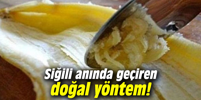 Siğili anında geçiren doğal yöntem!