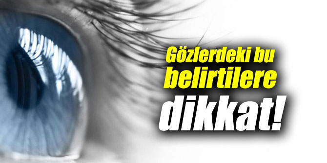 Gözlerdeki bu belirtilere dikkat