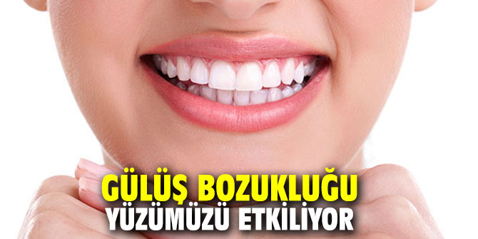 Uzmanı açıkladı: Gülüş bozukluğu yüzümüzü etkiliyor