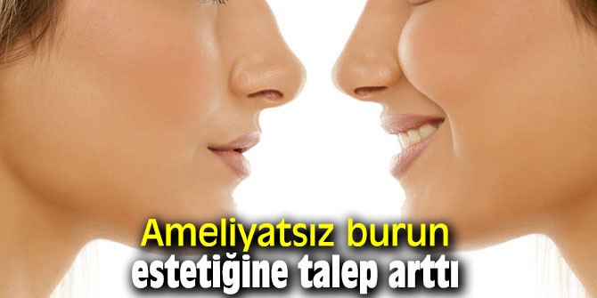 Ameliyatsız burun estetiğine talep arttı