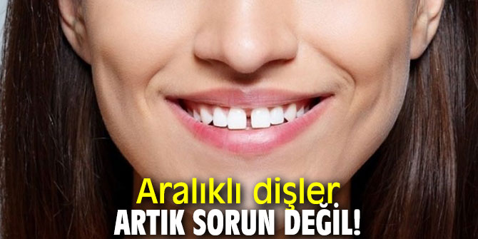 Aralıklı dişler artık sorun değil!