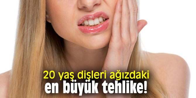 20 yaş dişleri ağızdaki en büyük tehlike!