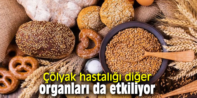 Çölyak hastalığı diğer organları da etkiliyor
