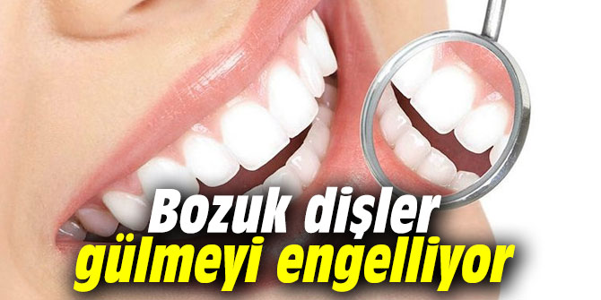 Bozuk dişler gülmeyi engelliyor