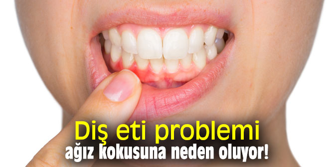 Diş eti problemi ağız kokusuna neden oluyor!