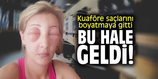 Kuaföre saçlarını boyatmaya gitti bu hale geldi