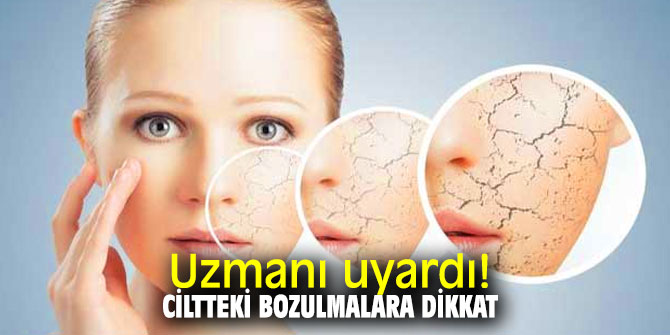 Uzmanı uyardı! Ciltteki bozulmalara dikkat