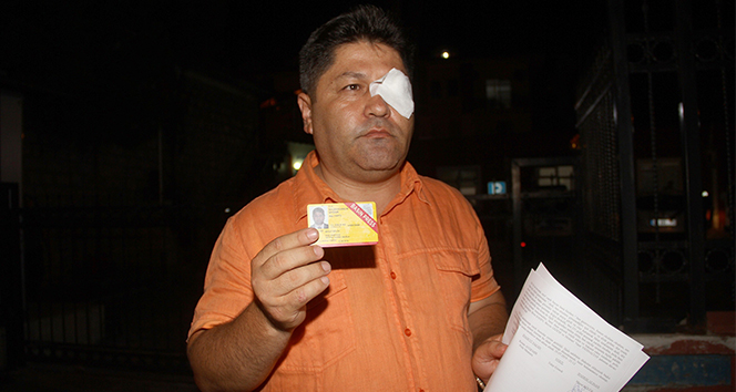 Gazeteci Mesut Bölük'e çirkin saldırı